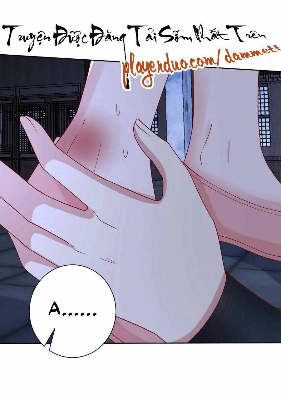 Độc Y Đích Nữ Chapter 170 - 5