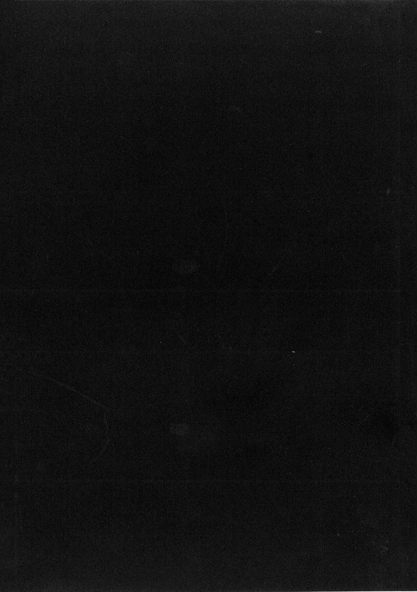 Battle Angel Alita Last Order Chapter 62 - 31