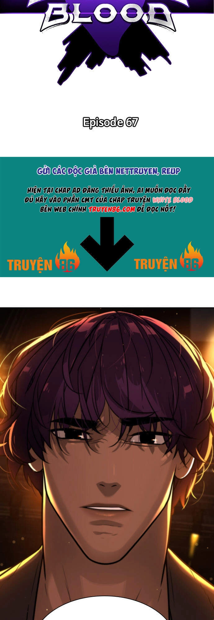 Máu Trắng Chapter 67 - 3