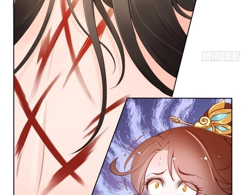 Nàng Trở Thành Bạch Nguyệt Quang Của Vương Gia Bệnh Kiều Chapter 12 - 5