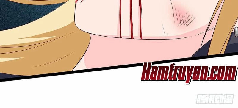 Thần Cấp Thấu Thị Chapter 111 - 30