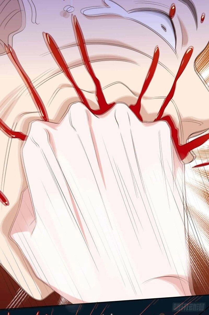 Thần Cấp Thấu Thị Chapter 113 - 33