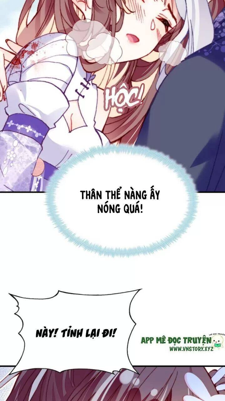 Lại Bị Bệnh Chiều Chuộng Quấn Lấy Chapter 25 - 45