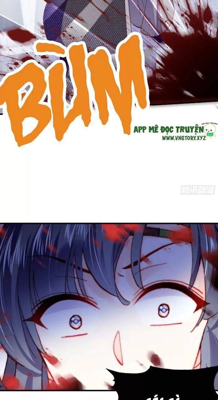 Lại Bị Bệnh Chiều Chuộng Quấn Lấy Chapter 31 - 51