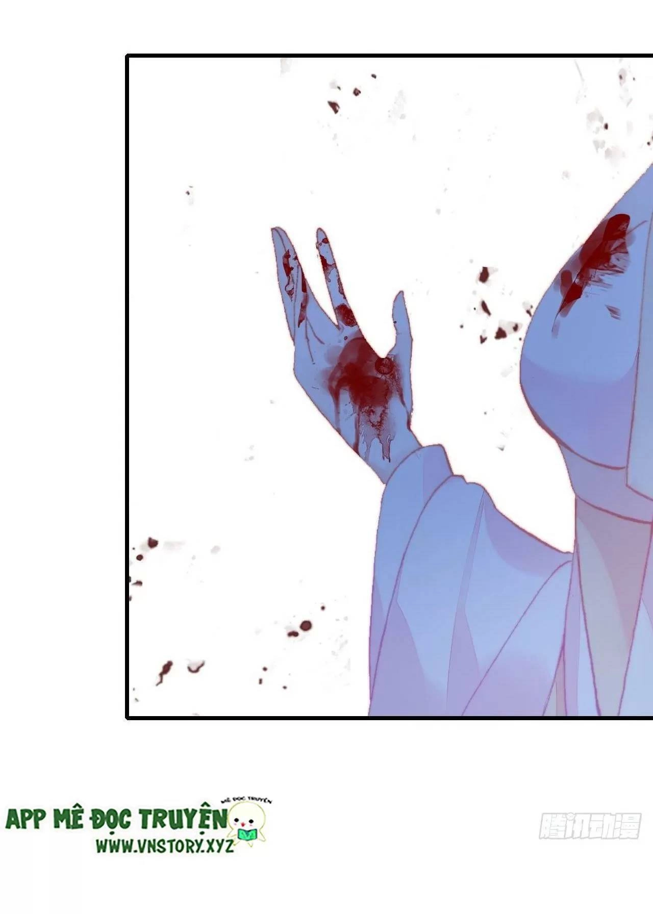 Lại Bị Bệnh Chiều Chuộng Quấn Lấy Chapter 75 - 18