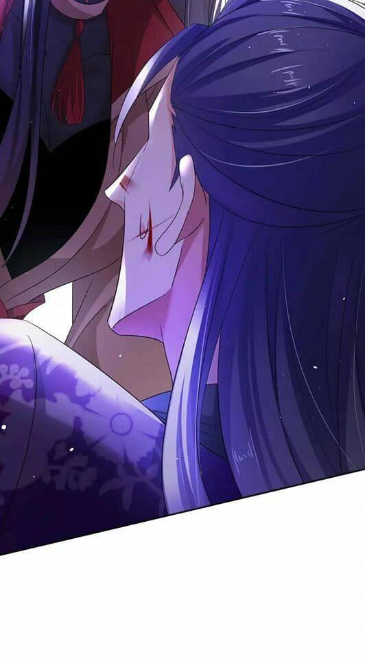 Ta Ở Dị Giới Nuôi Dưỡng Nam Thần: Thần Y Cửu Tiểu Thư Chapter 126 - 21