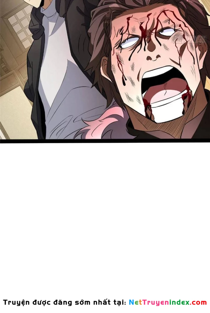 Đô Thị Cực Phẩm Y Thần Chapter 308 - 45