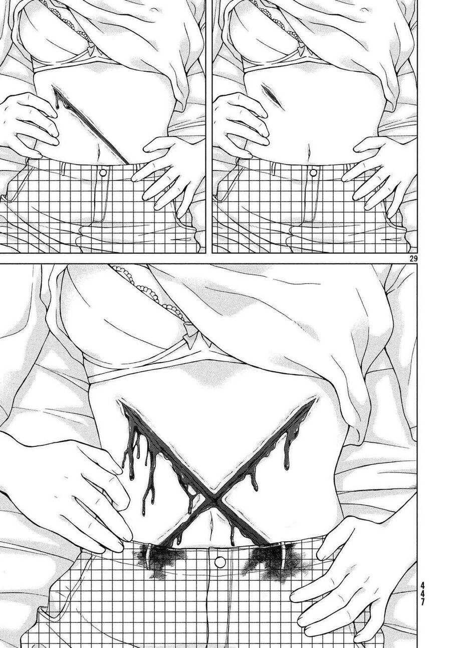 Aono-Kun Ni Sawaritai Kara Shinitai Chapter 20 - 31