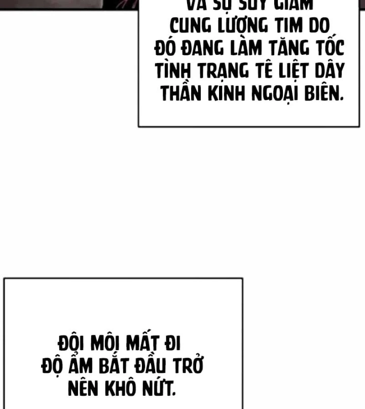 Đại Chiến Tử Thi Chapter 55 - 11