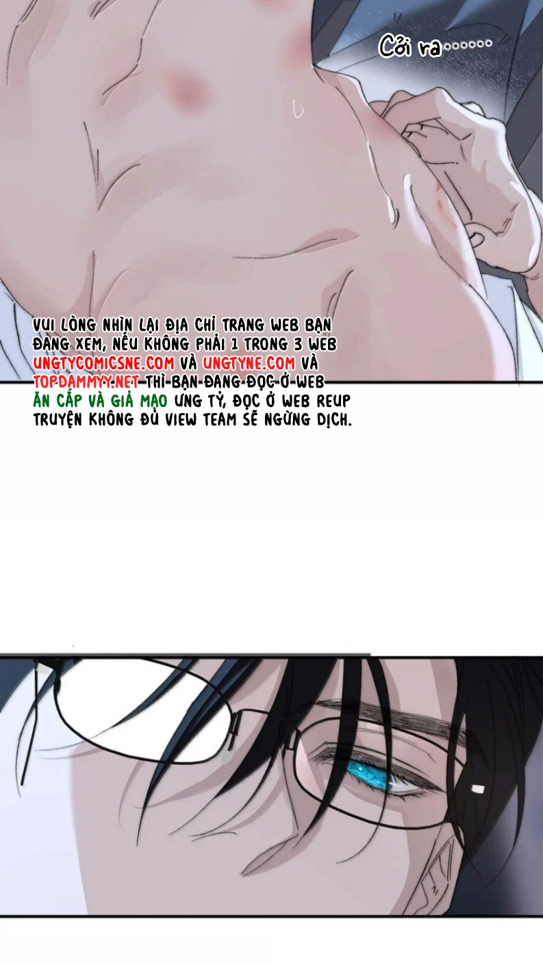 Ngày Nào Cũng Muốn Làm Vương Tủ Bệnh Kiều Phải Xấu Hổ Chapter 52 - 31