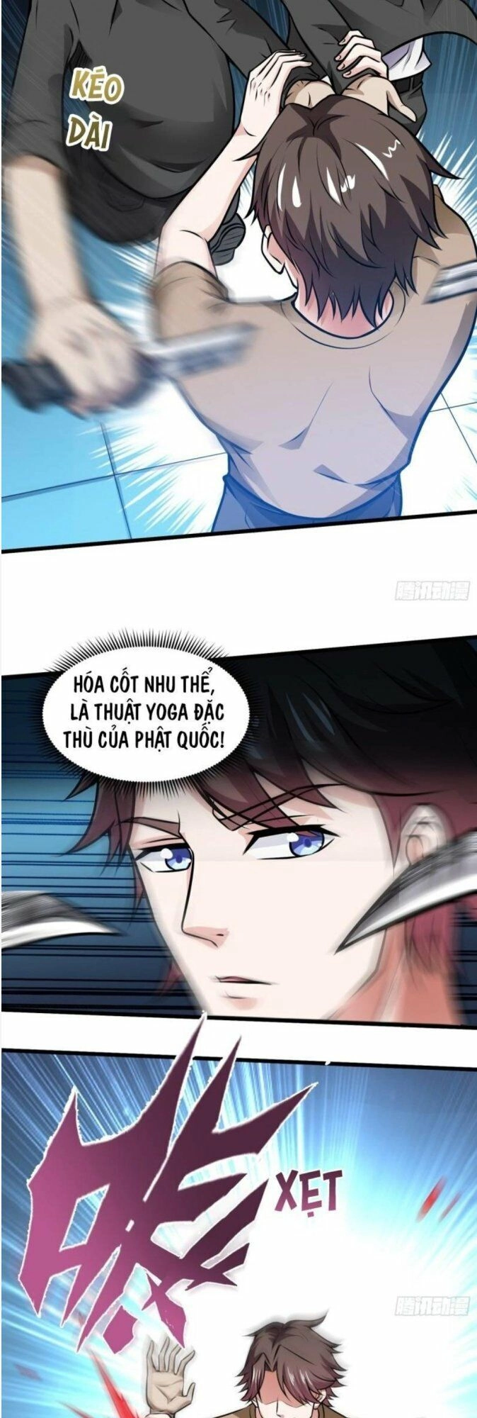 Siêu Cấp Thần Y Tại Đô Thị Chapter 65 - 11