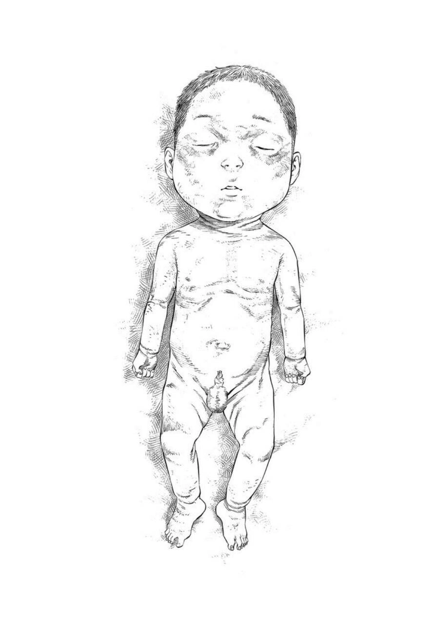 Give My Regards To Black Jack Chapter 33 - 12