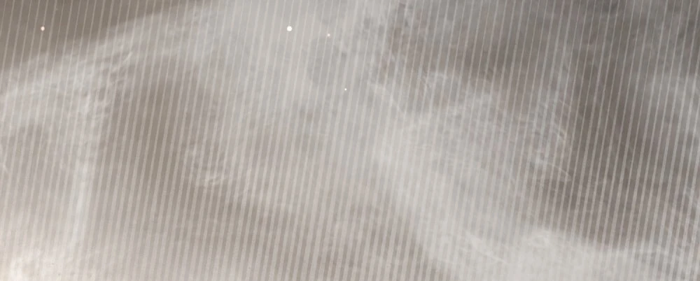 Merry Psycho Chapter 44.2 - 50