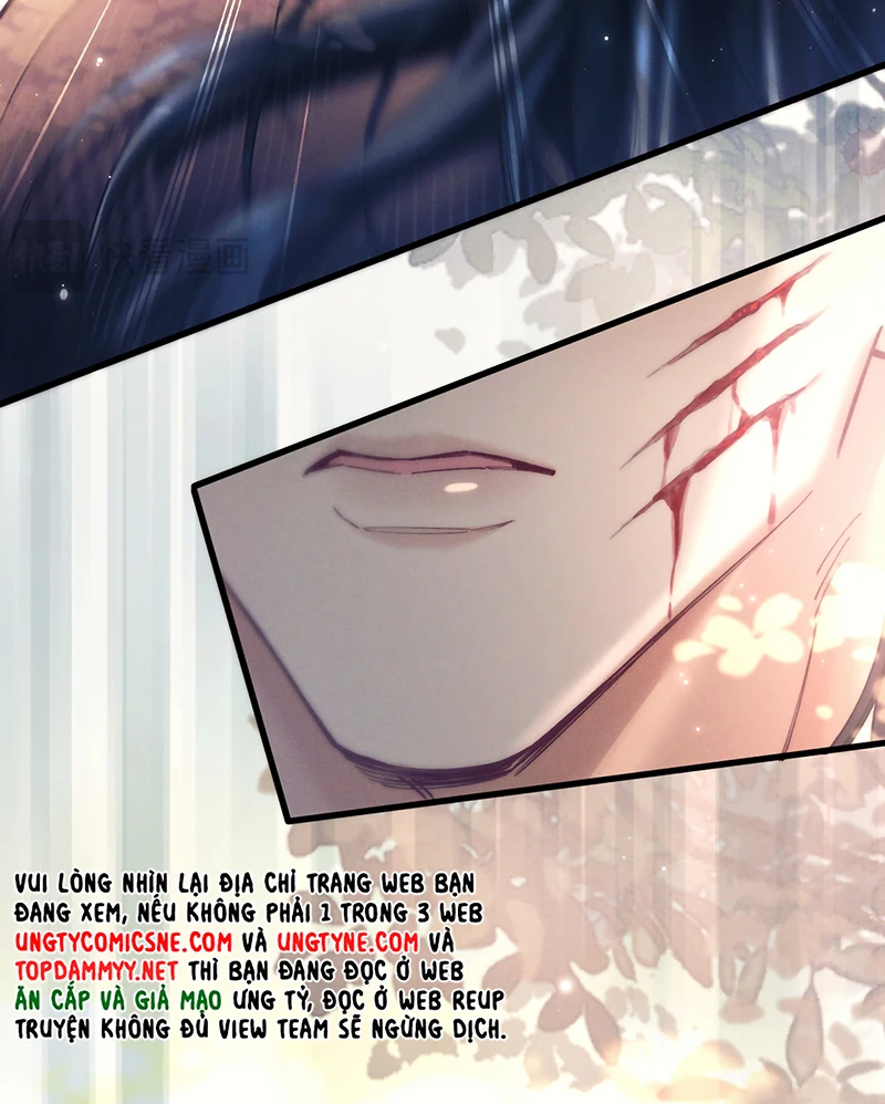 Yêu Là Mong Người Sống – [Hệ Thống Giết Vợ] Chapter 28 - 33