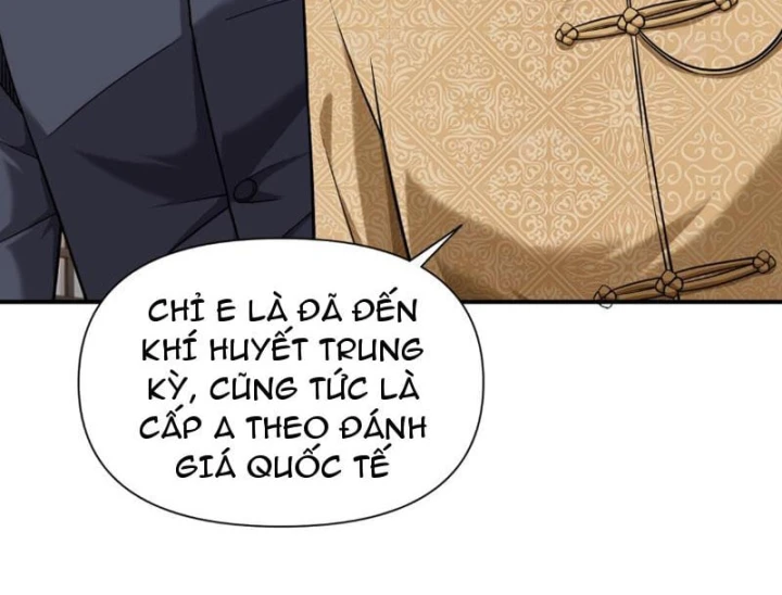 Tên Sát Thủ Này Lại Là Người Ở Rể Chapter 15 - 161