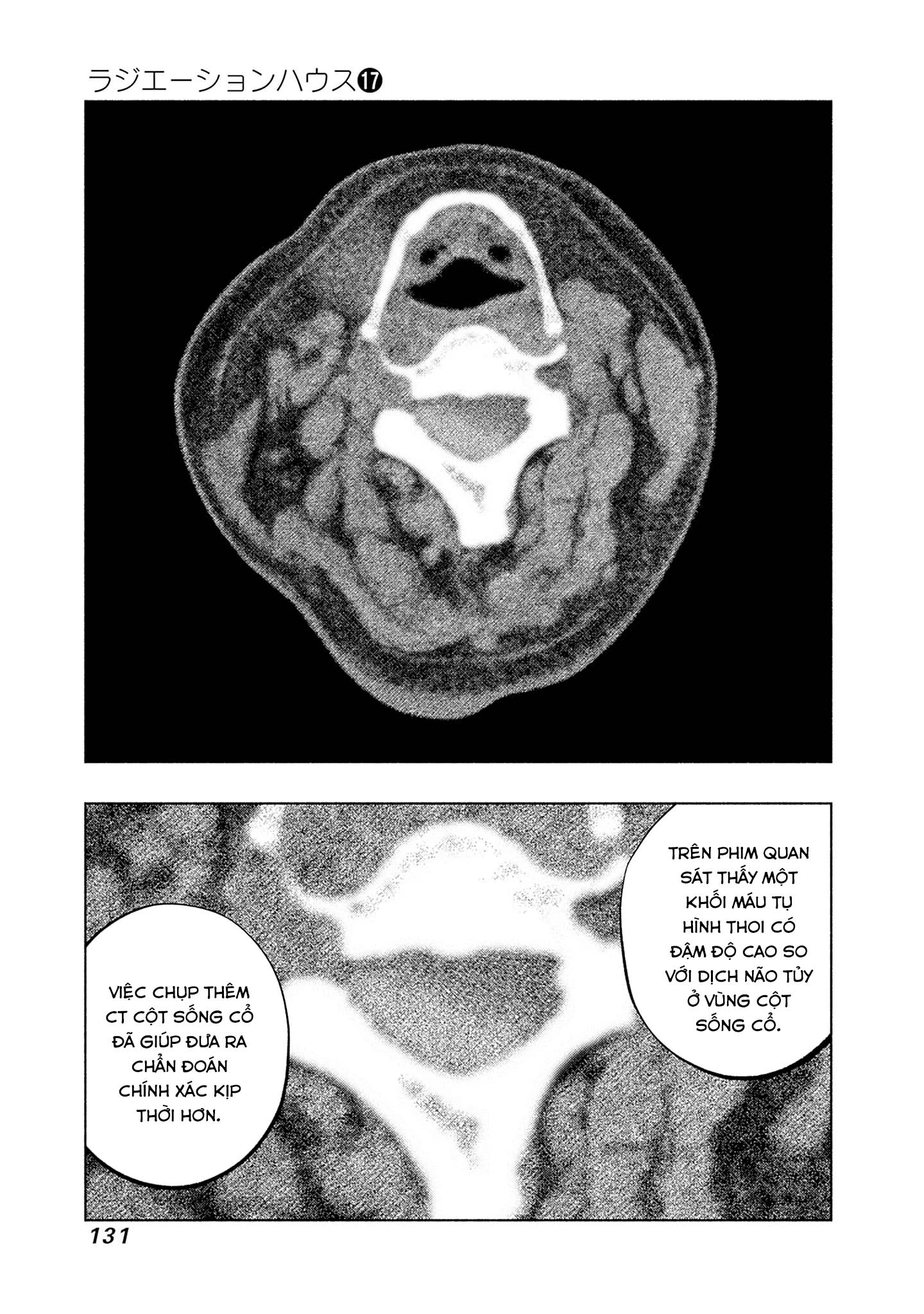 Radiation House Chapter 139 - 9