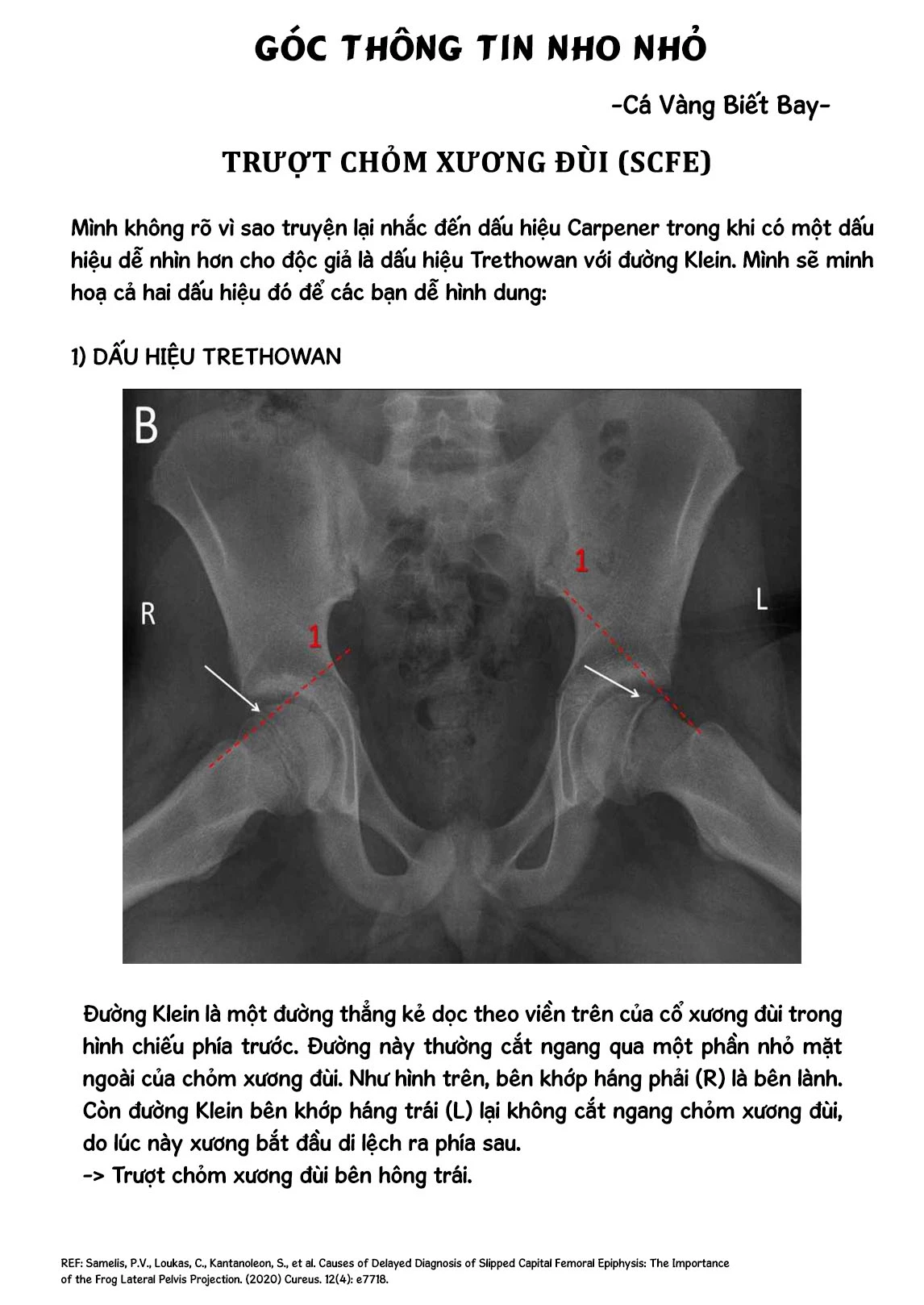 Radiation House Chapter 148 - 22