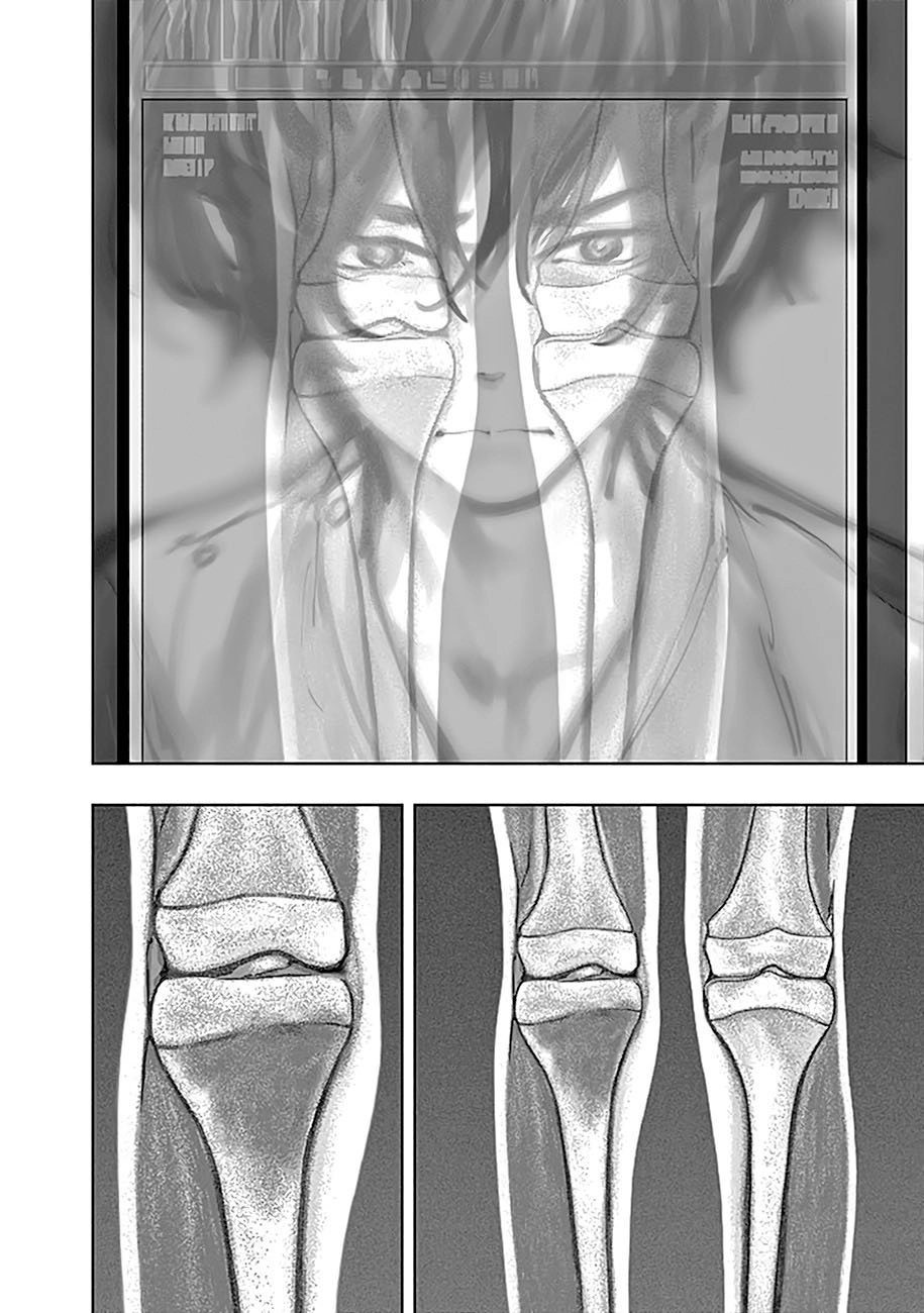 Radiation House Chapter 9 - 11