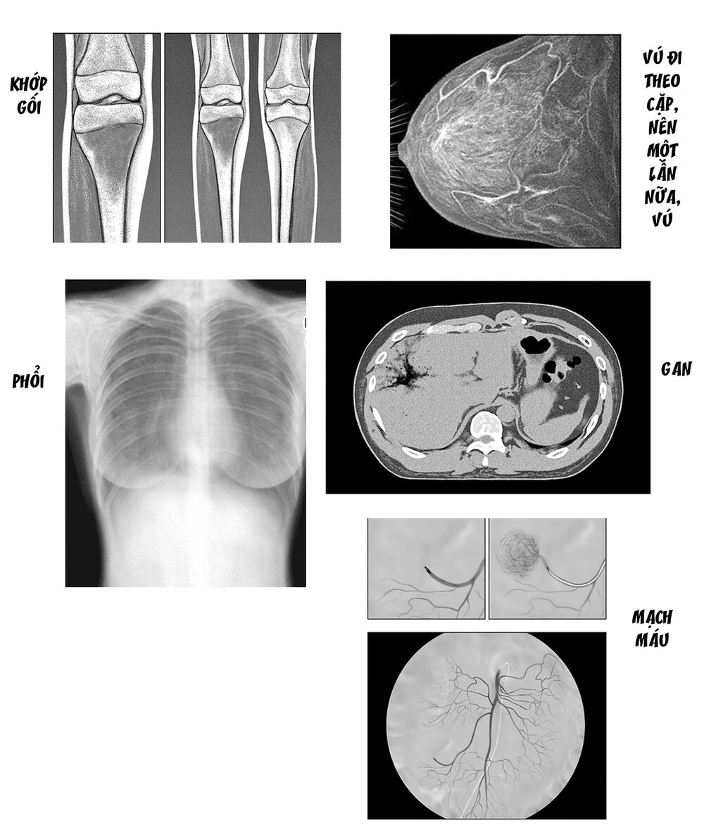 Radiation House Chapter 50 - 24