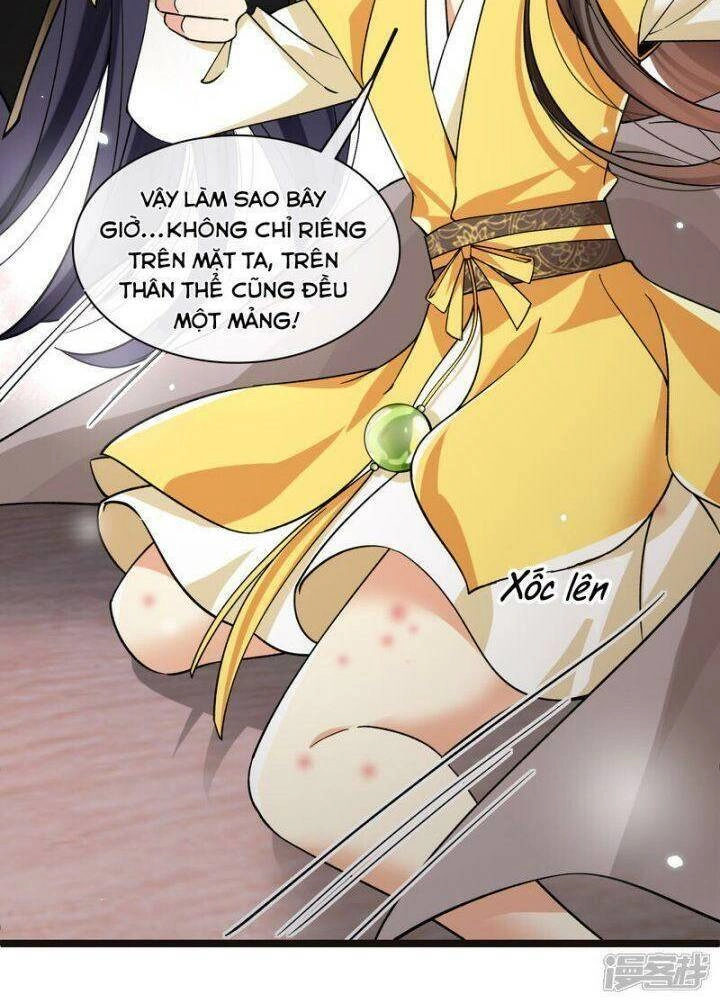 Nụ Cười Của Ngươi Ngọt Đến Mức Làm Gãy Tám Cái Răng Của Ta Chapter 75 - 15