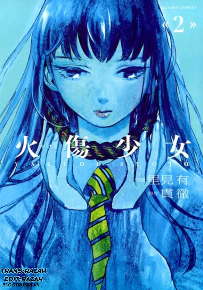 Yakedo Shoujo Chapter 7 - 1