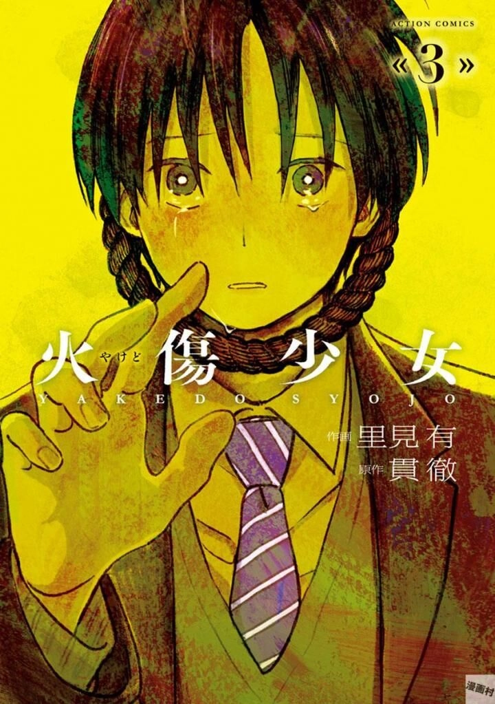 Yakedo Shoujo Chapter 16 - 1