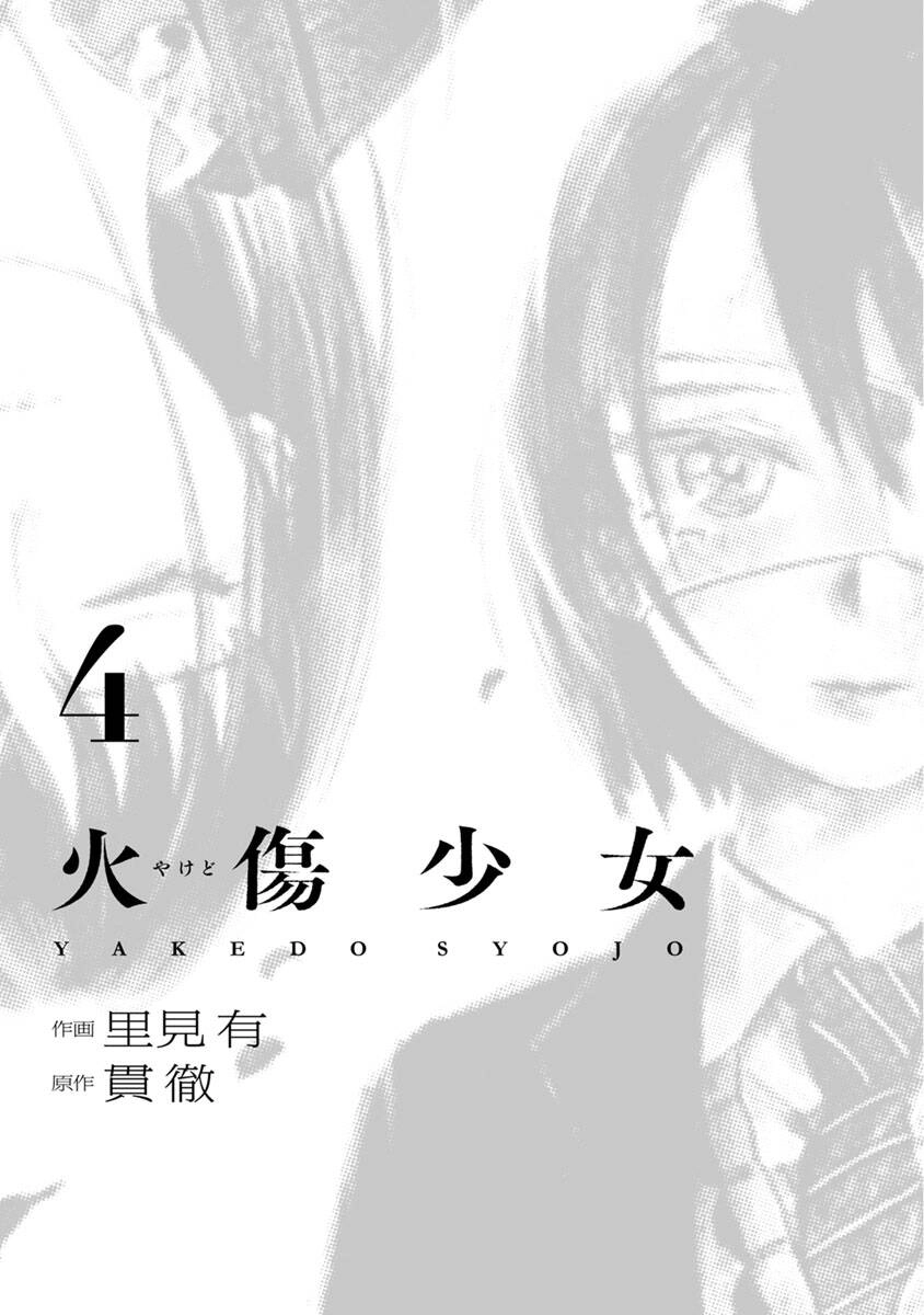 Yakedo Shoujo Chapter 17 - 4