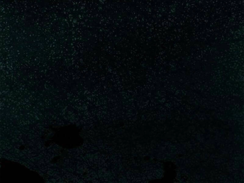 Quỷ Dị Khó Giết? Thật Xin Lỗi, Ta Mới Thật Sự Là Bất Tử Chapter 42 - 32