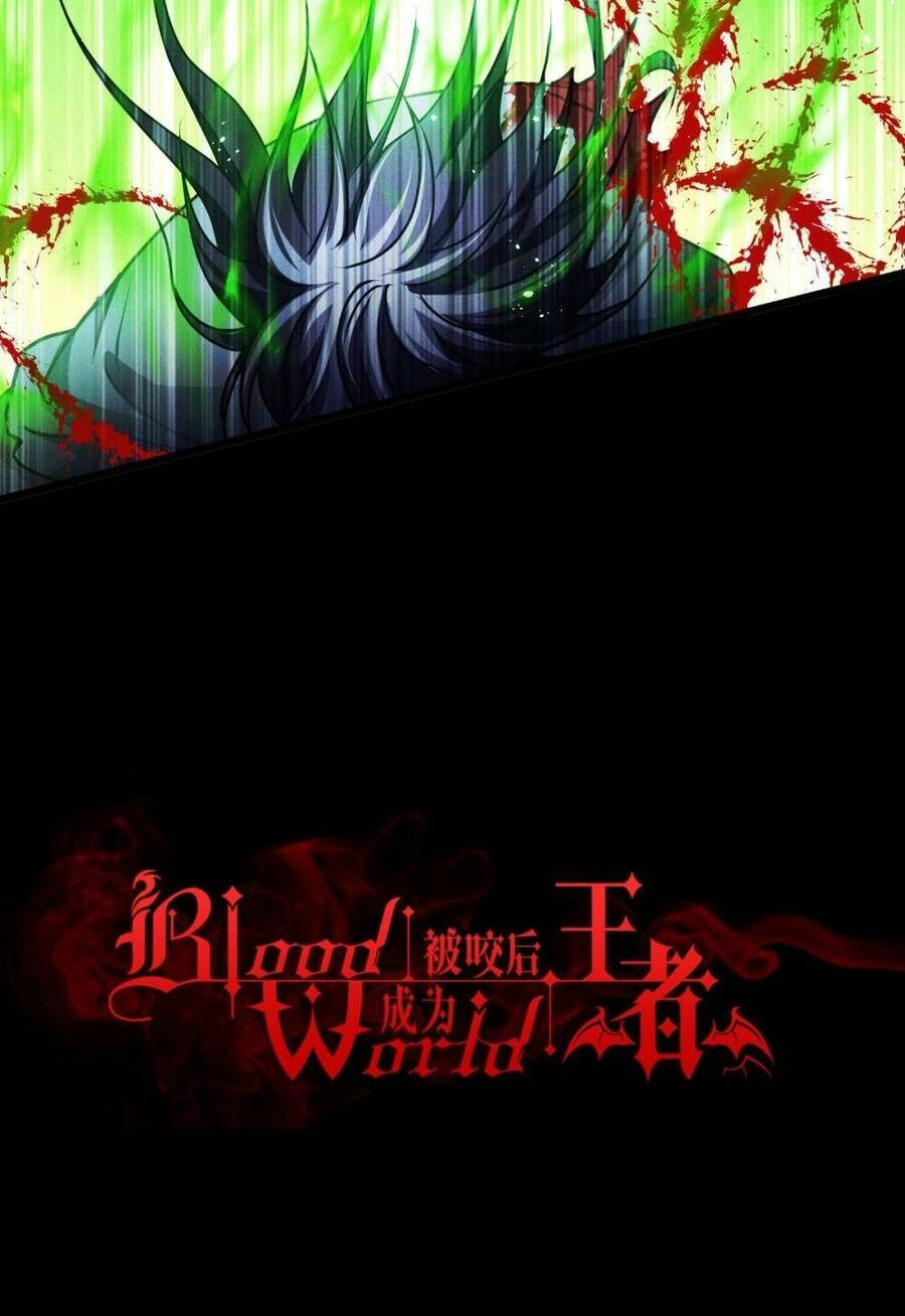 Bị Cắn Thành Vương Giả Chapter 81 - 7