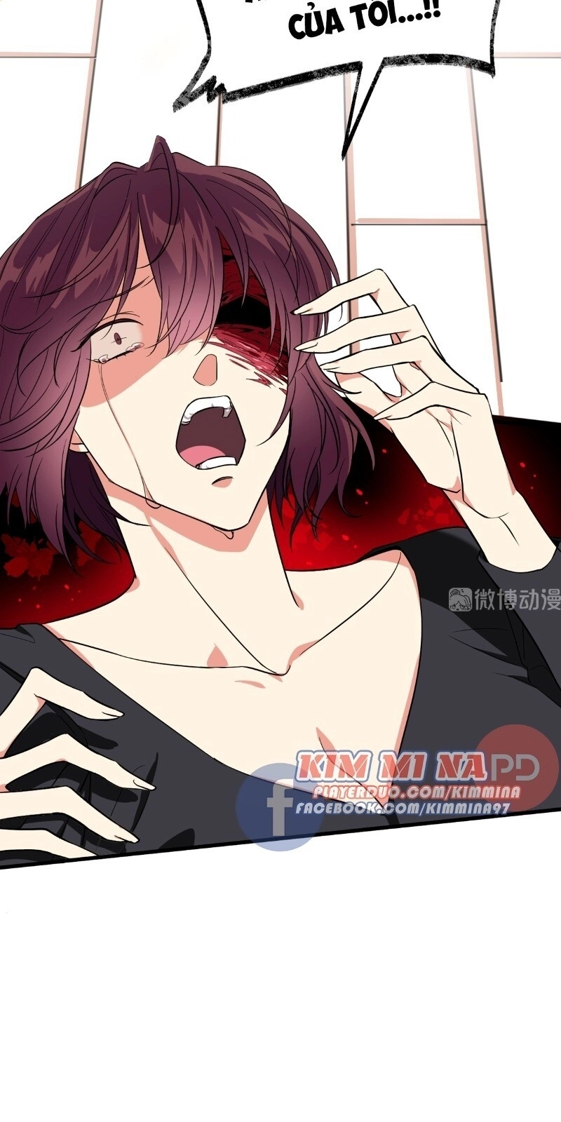 Vết Cắn Trí Mạng Chapter 2 - 17