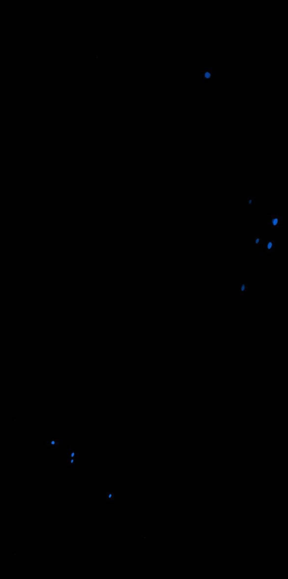 Serena Chapter 31.2 - 11