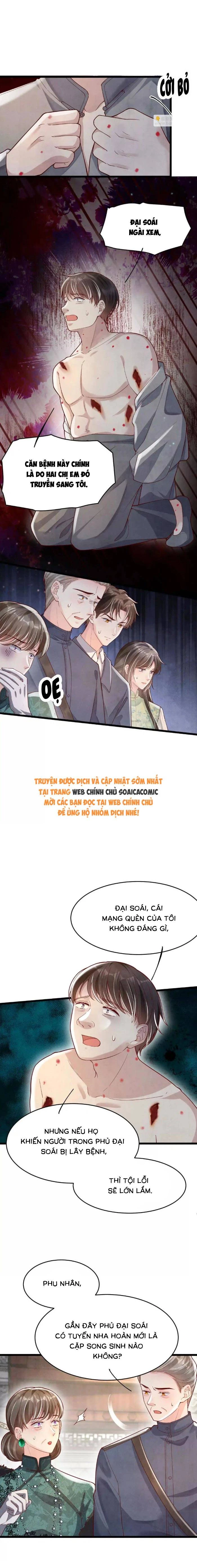 Tôi Có Ông Chồng Hay Ghen Chapter 170 - 3