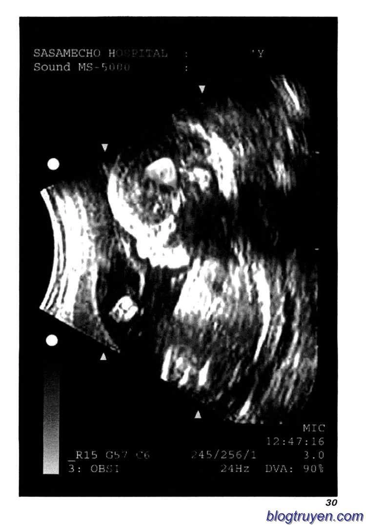 Elfen Lied Chapter 72 - 29