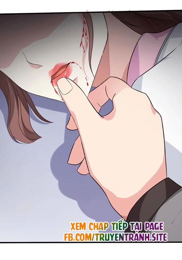 Cưng Chiều Vợ Cũ Lão Bà Đại Nhân Thật Mê Người Chapter 81 - 11