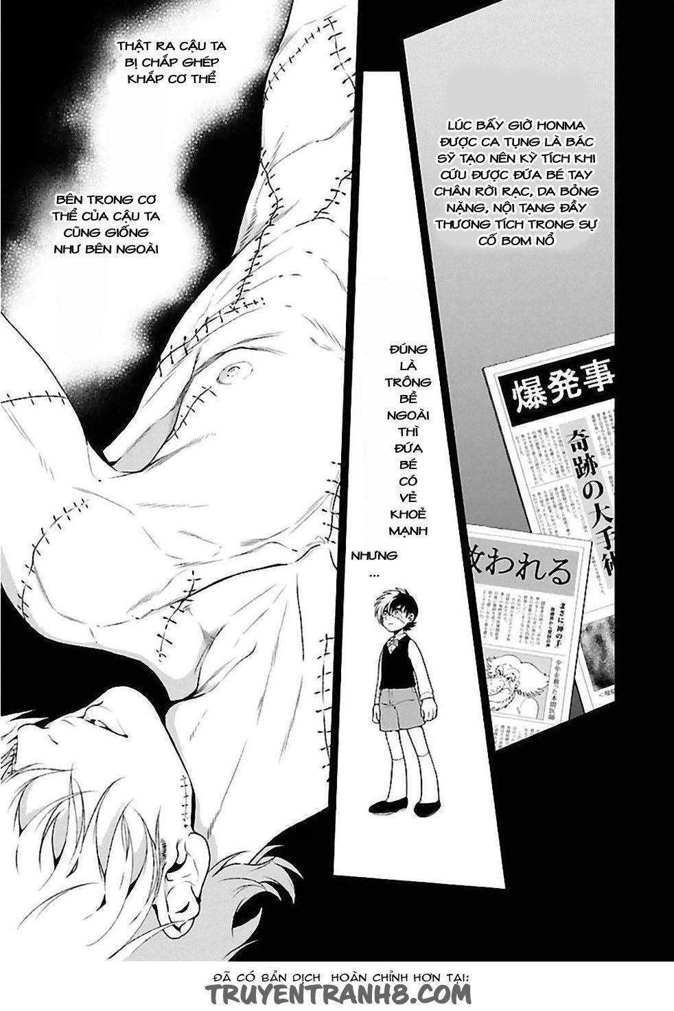 Thời Niên Thiếu Của Black Jack Chapter 28 - 16