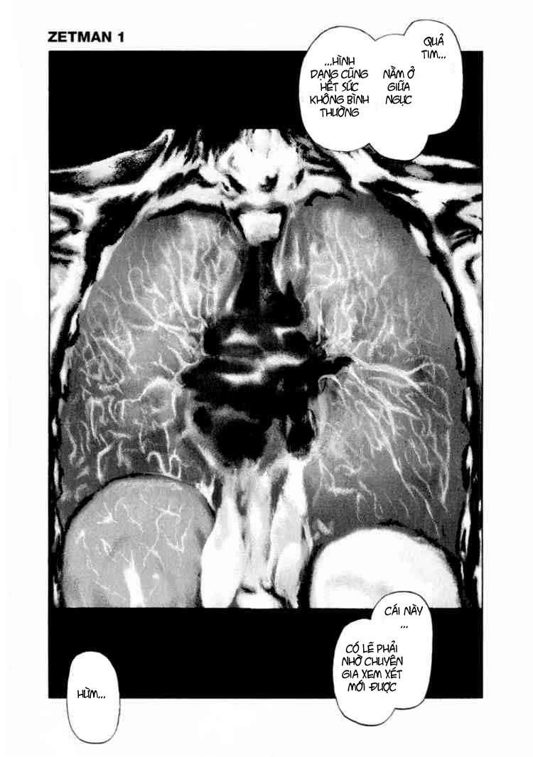 Zetman Chapter 11 - 5