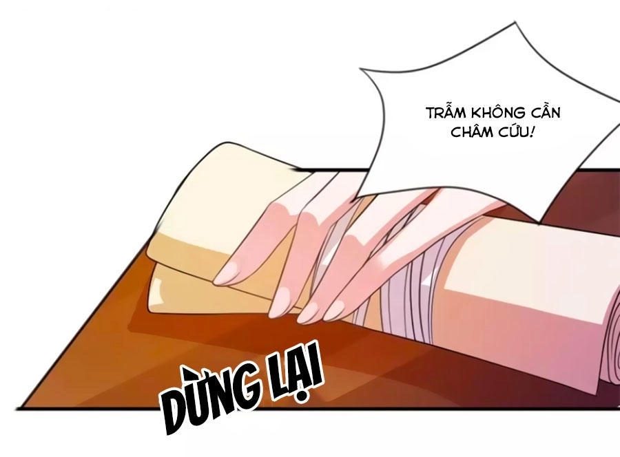 Khuynh Thế Y Phi Muốn Bỏ Chồng Chapter 44 - 17