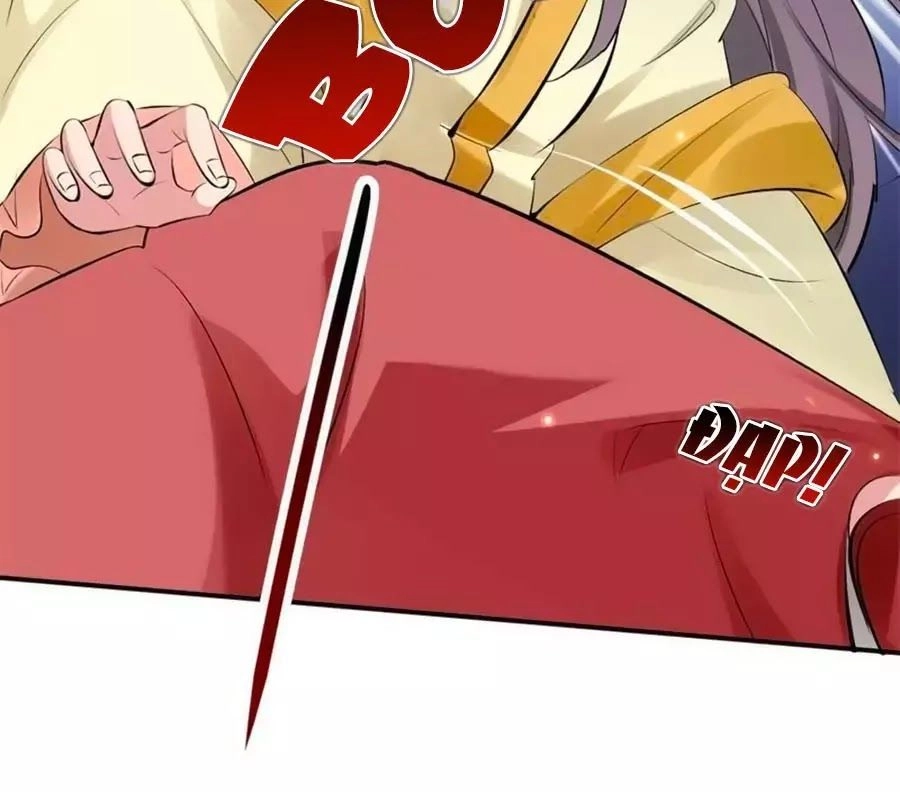 Tuyệt Thế Thần Y: Phúc Hắc Đại Tiểu Thư Chapter 30 - 17