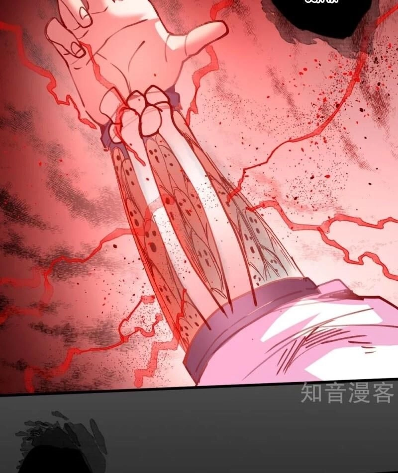 Tối Cường Đại Biểu Hoàng Kim Thận Chapter 104 - 17