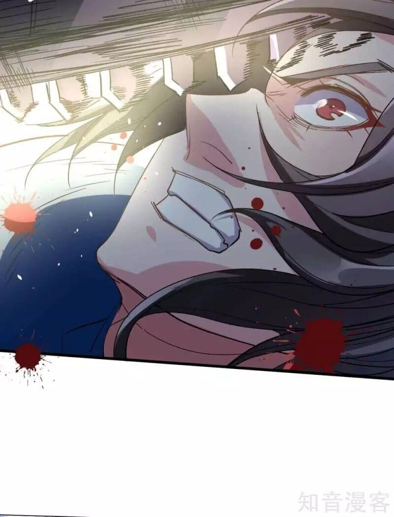 Tối Cường Đại Biểu Hoàng Kim Thận Chapter 109 - 11