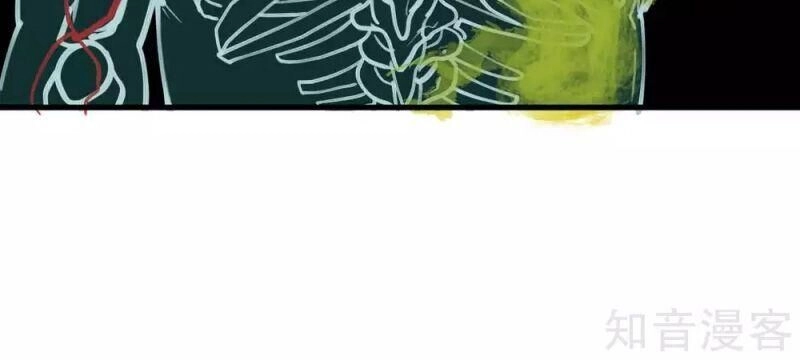 Tối Cường Đại Biểu Hoàng Kim Thận Chapter 113 - 14