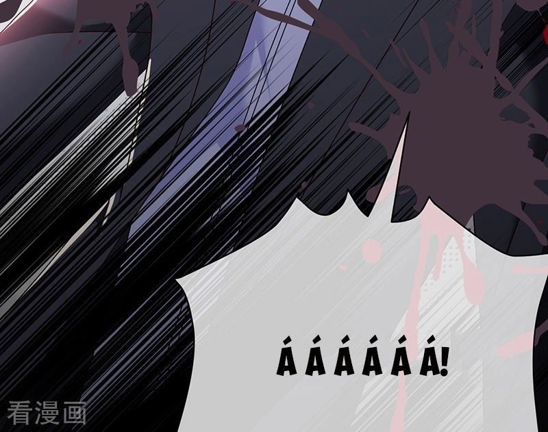 Ác Ma Đừng Hôn Tôi Chapter 118 - 30