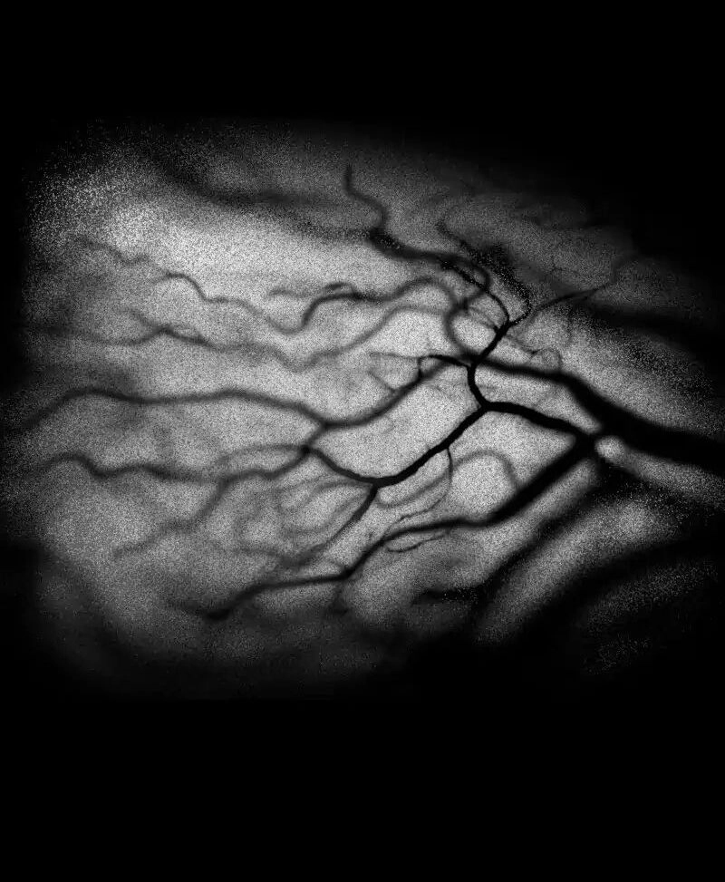 Liệu Pháp Của Melvina Chapter 26 - 20