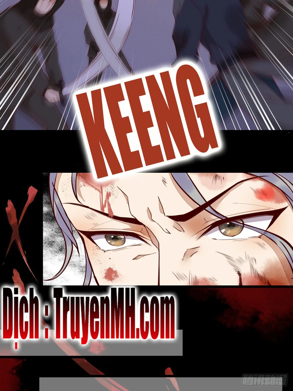 Sát Thủ Vương Phi Không Dễ Chọc Chapter 34 - 5